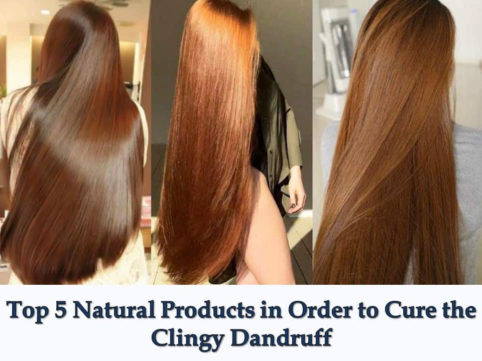 Top 5 Natural Products in Order to Cure the Clingy Dandruff