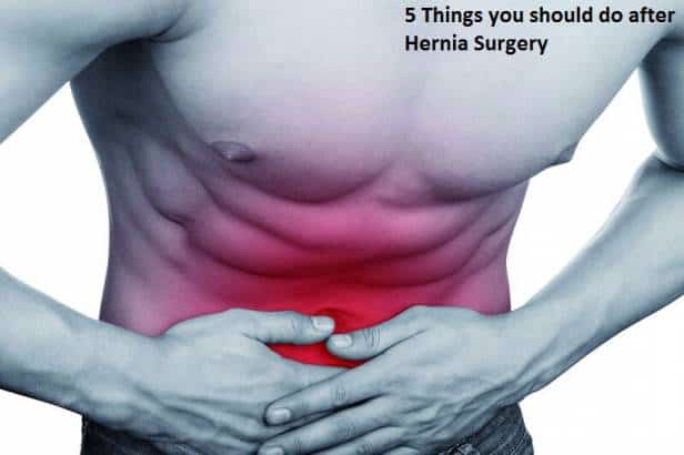 5 Things you should do after Hernia Surgery