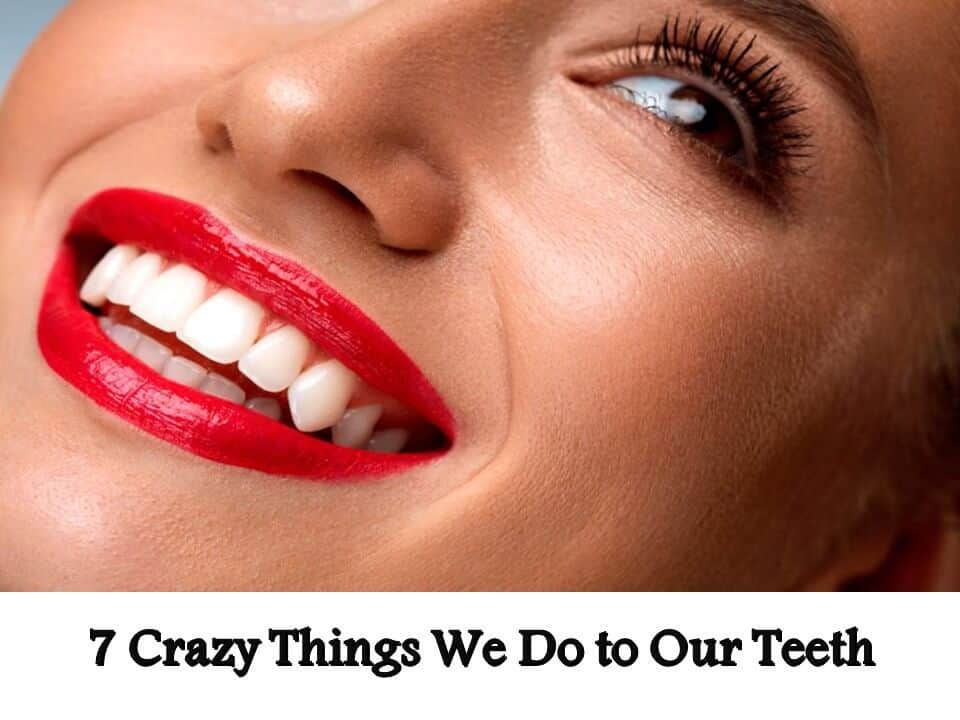 7 Crazy Things We Do to Our Teeth