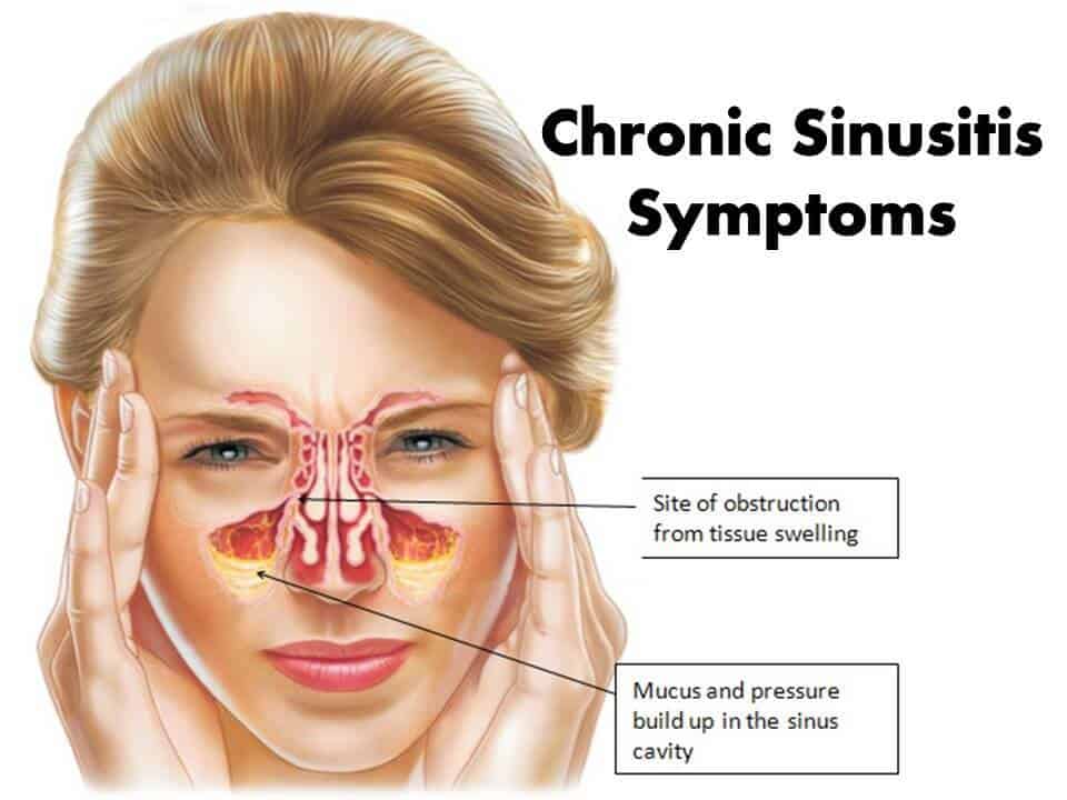 sinus pain diving